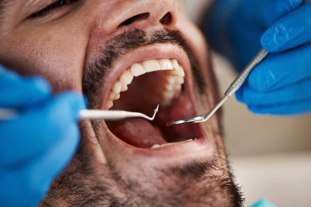 Best Teeth Whitening  in Henryetta, OK
